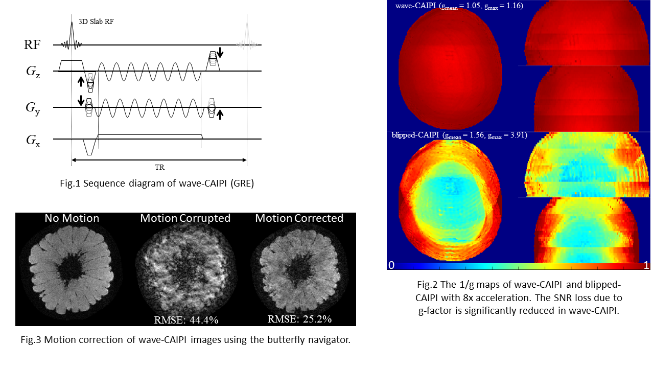 Motion-corrected wave-CAIPI Imaging